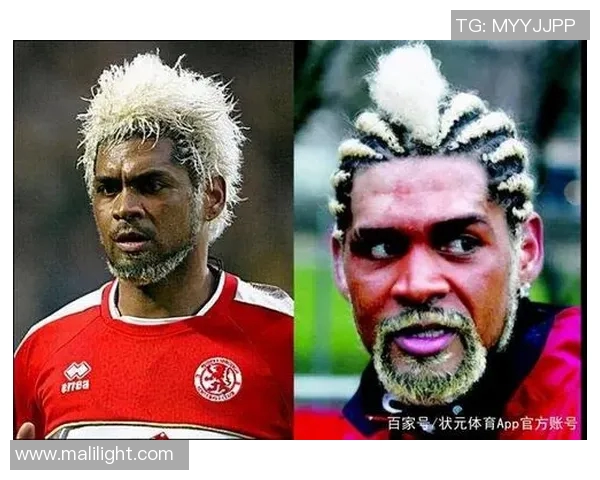 足球场上的奇葩发型盘点：这些球星的发型让人瞠目结舌